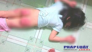 Xót xa người mẹ cầu cứu vì con gái 6 tuổi bị cha ruột hành hạ dã man