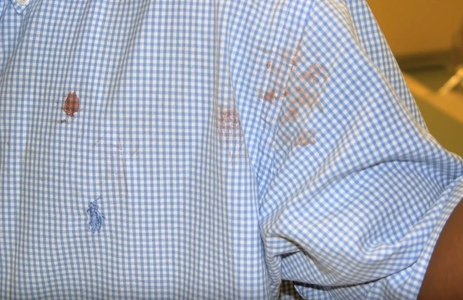  Vết máu trên áo của Keyon.